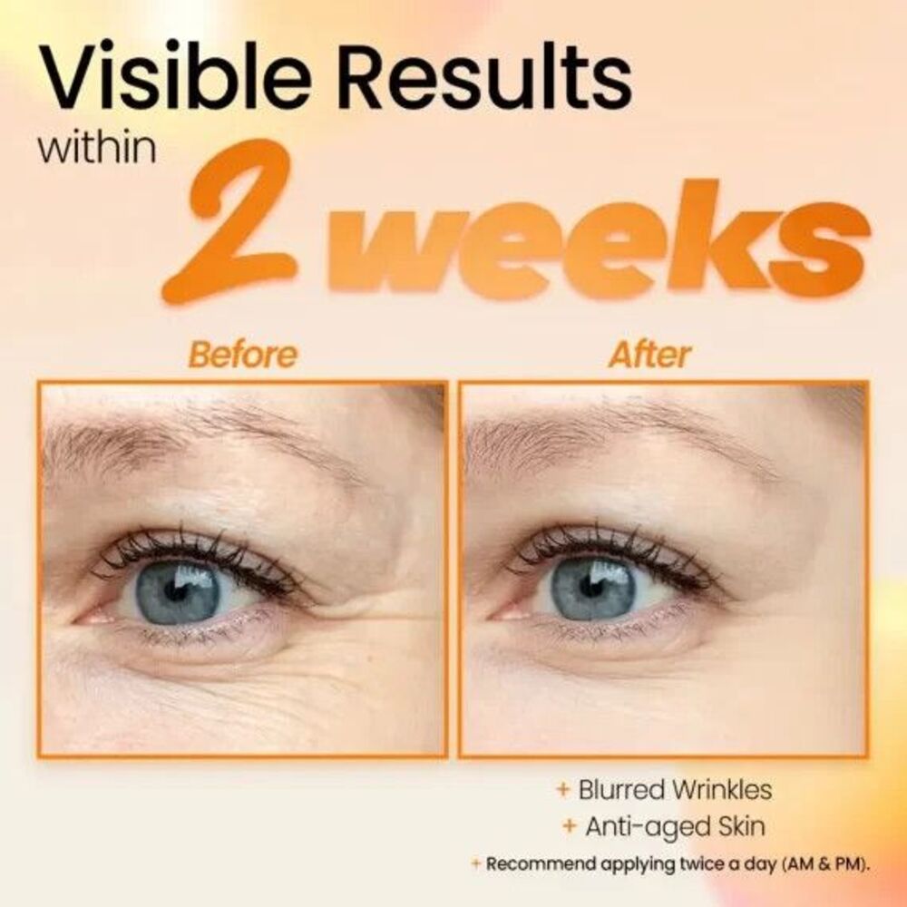 Glam UP-Core Vitalizing-Vitamin C + Turmeric- Serum - Picture 3 of 4